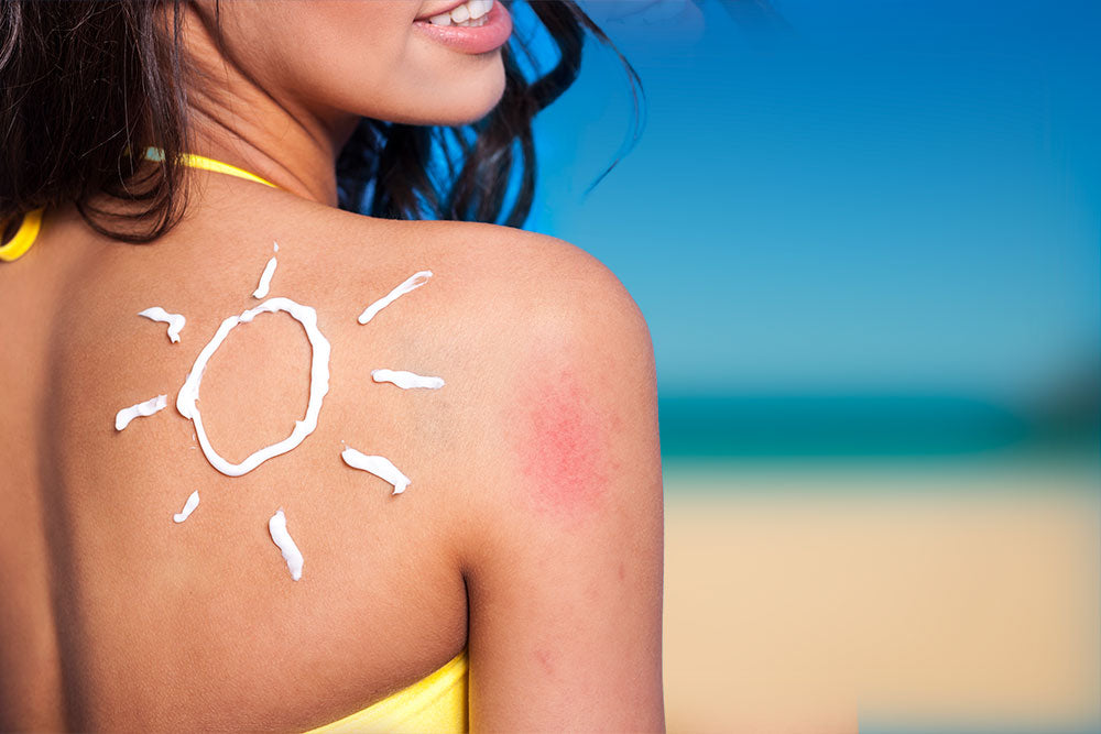 Woman on the beard with sun block on psoriais skin