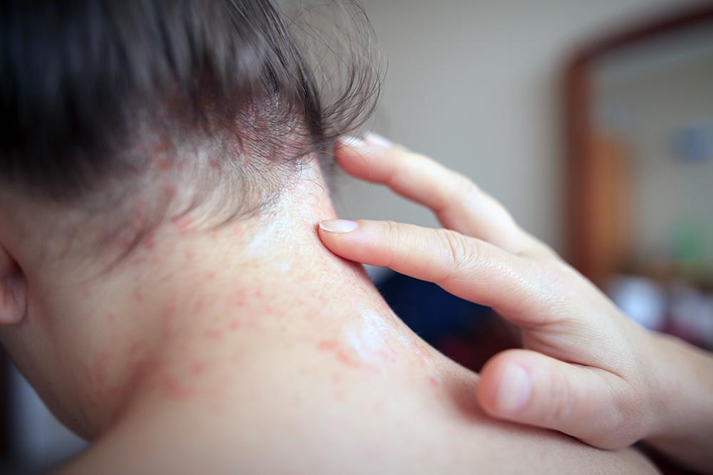 woman pointing to neck with dry skin
