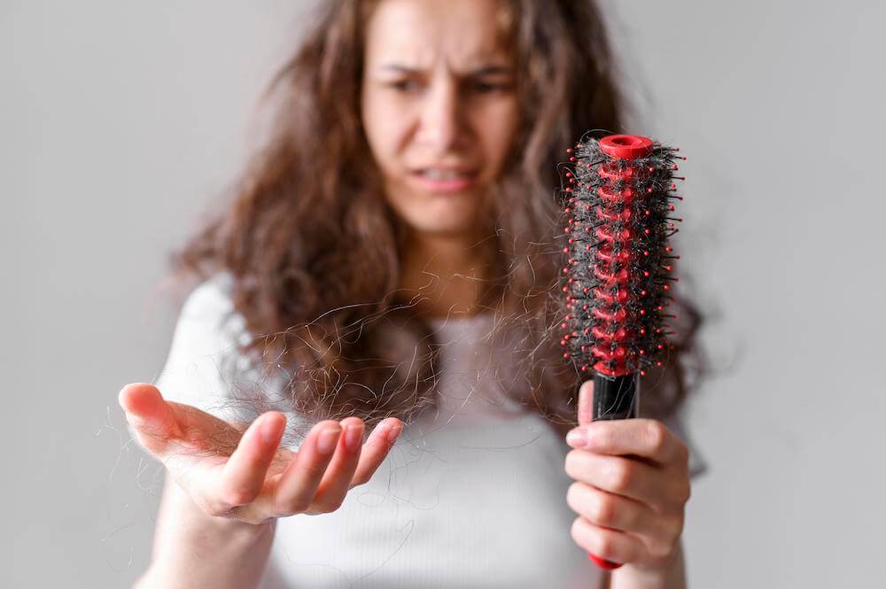 woman suffering from Alopecia