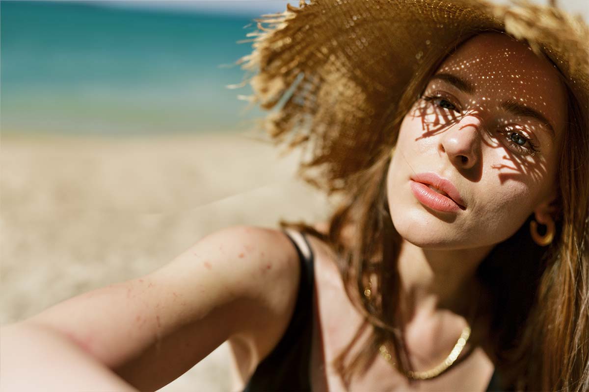 woman with psoriasis in the sun on the beach