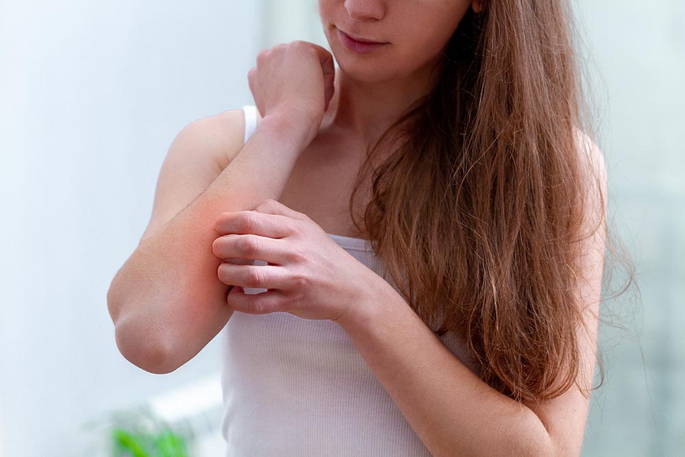 woman scratching arm because of psoriasis